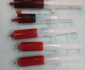 Venous and arterial blood